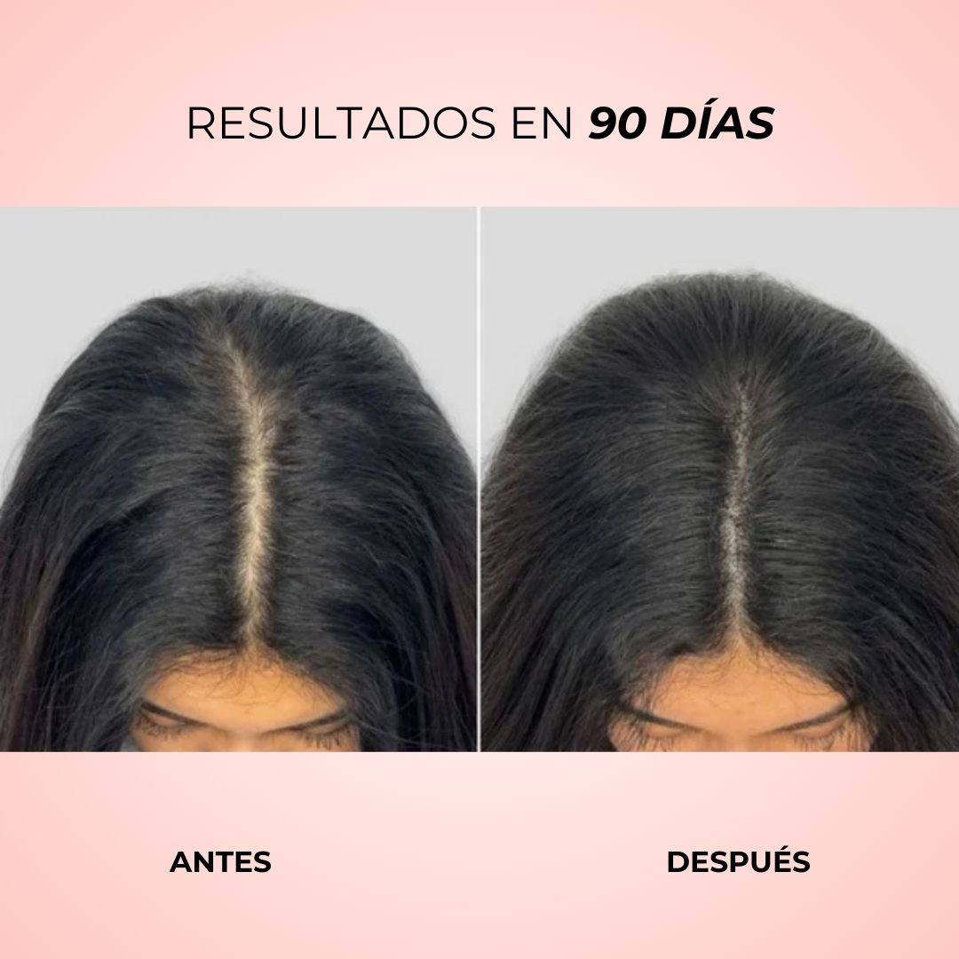 Glow Up Brush™ | Cepillo LED estimulador del crecimiento ✨