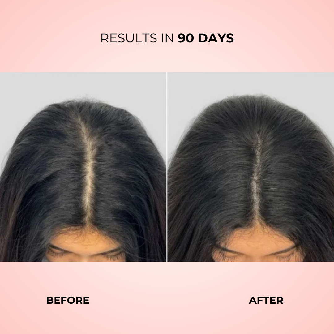 Glow Up Brush™ | LED Hair Growth Stimulating Brush